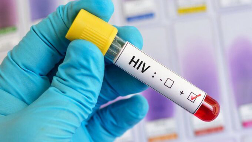 Global fight against HIV 'In Danger' amid resource crunch, says UN | News