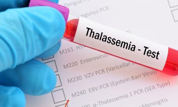 Testing blood before marriage can prevent Thalassemia: experts