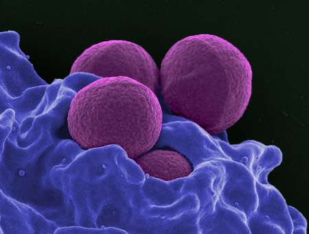UK rise in superbugs pose challenge for govt: study