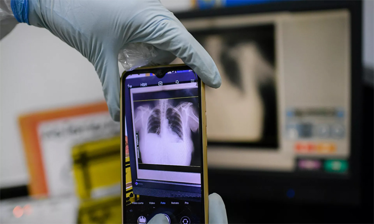 Childhood TB cases rising in Europe, Central Asia: health agencies
