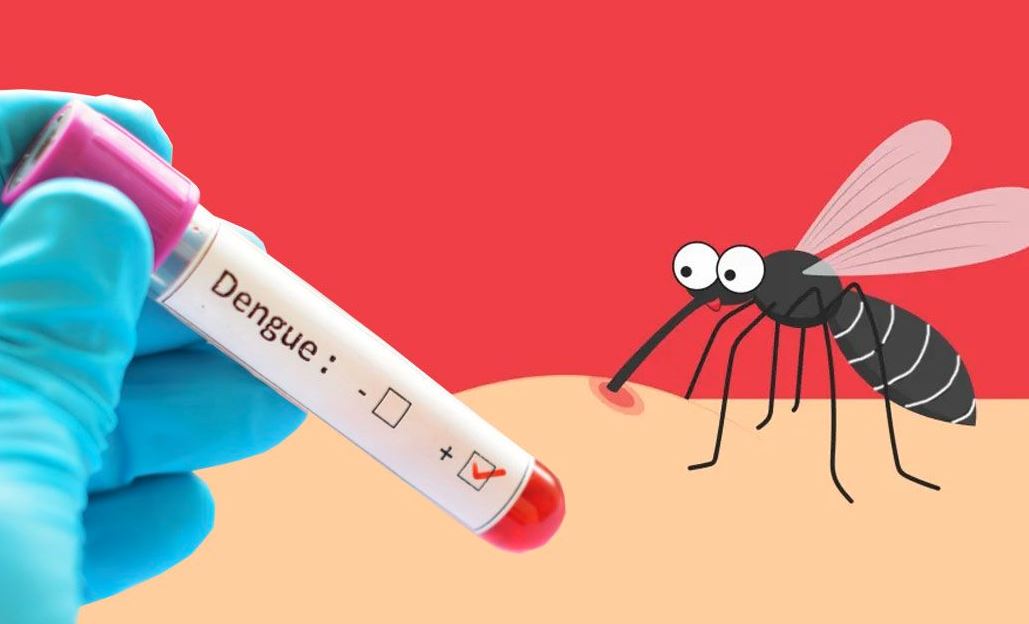 31 dengue patients hospitalized in last 24hrs