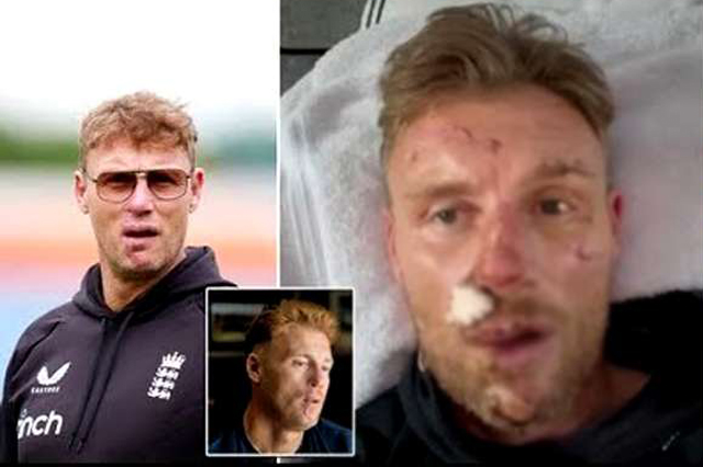Former England star Flintoff reveals mental battle after car crash