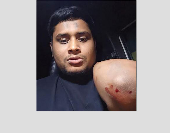 Protests erupt nationwide over attack on NCP leader Hasnat Abdullah