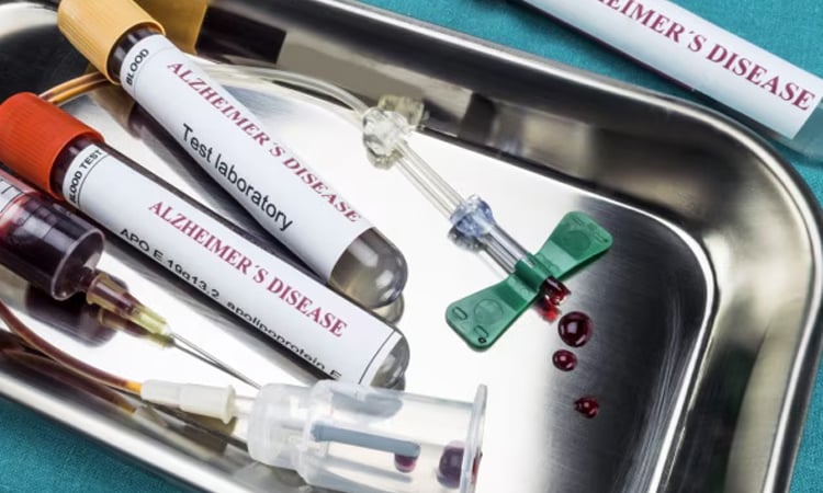 US approves first blood test for Alzheimer's