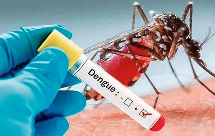 83 dengue patients hospitalized in last 24 hrs