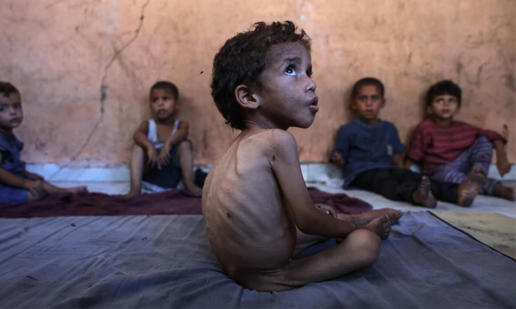 'Famine', 'starvation': the challenges in defining Gaza's plight