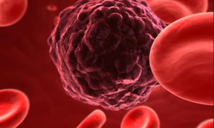 Liver cancer to double worldwide, most of it preventable: study