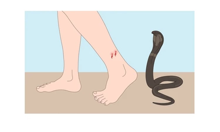 Madrasah student dies from snakebite in Naogaon