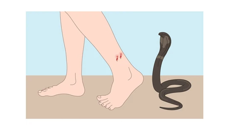 Schoolgirl dies from snakebite in Madaripur