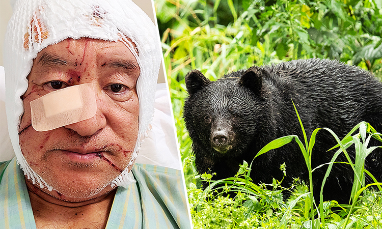 Tourist in Japan injured in latest bear attack | International