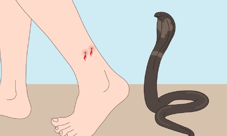 Snakebite kills electrician at Boalkhali