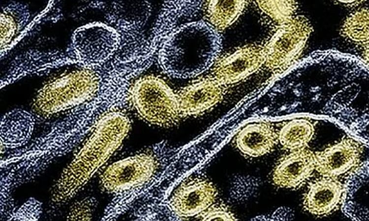 US records second human bird flu death of year