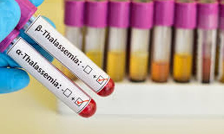 Experts urge awareness to curb rising thalassemia cases