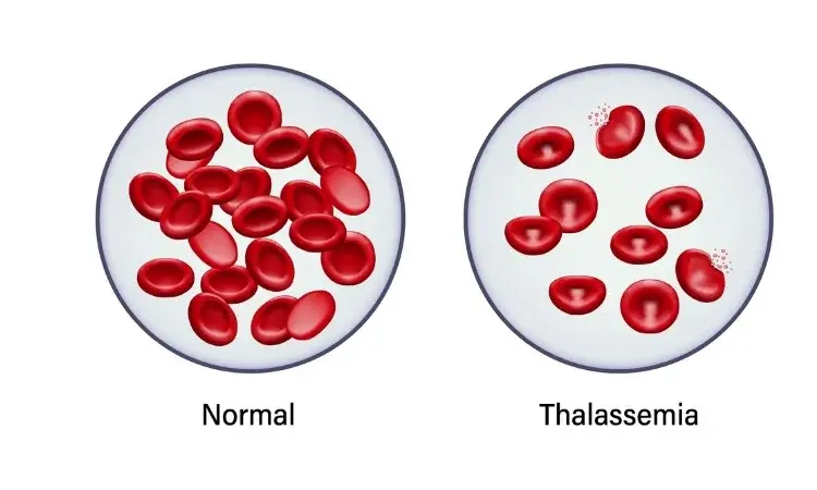 World Thalassaemia Day tomorrow