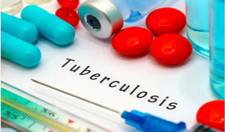 Early diagnosis, treatment key to curing drug-resistant TB: experts