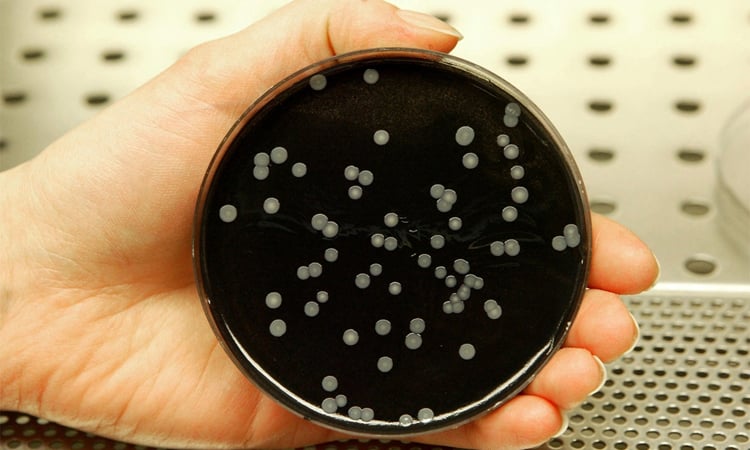 Three dead in Legionnaires' outbreak in Austria