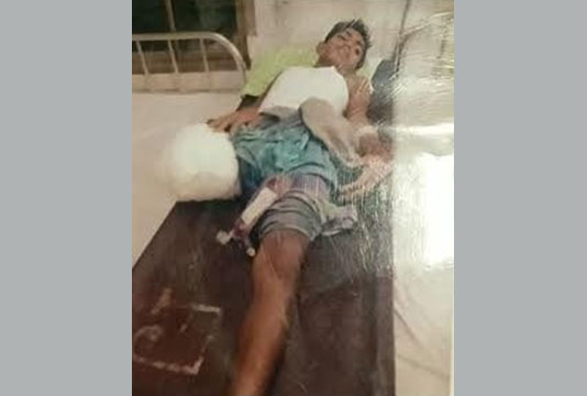মানবেতর দিন কাটাচ্ছেন পঙ্গু হয়ে পড়া কিশোর আলী হাসান