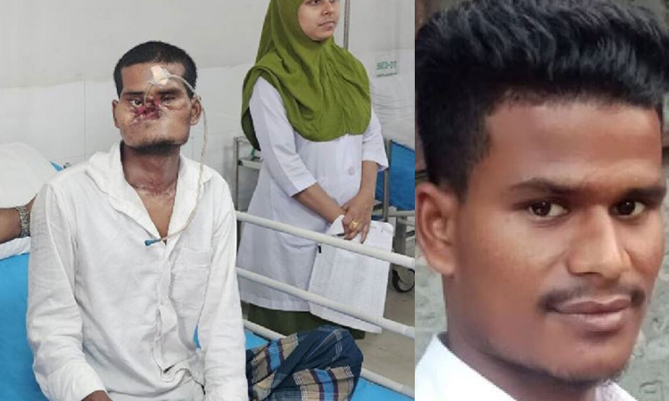 খোকন বর্মণকে উন্নত চিকিৎসার জন্য রাশিয়ায় পাঠানো হচ্ছে আগামীকাল