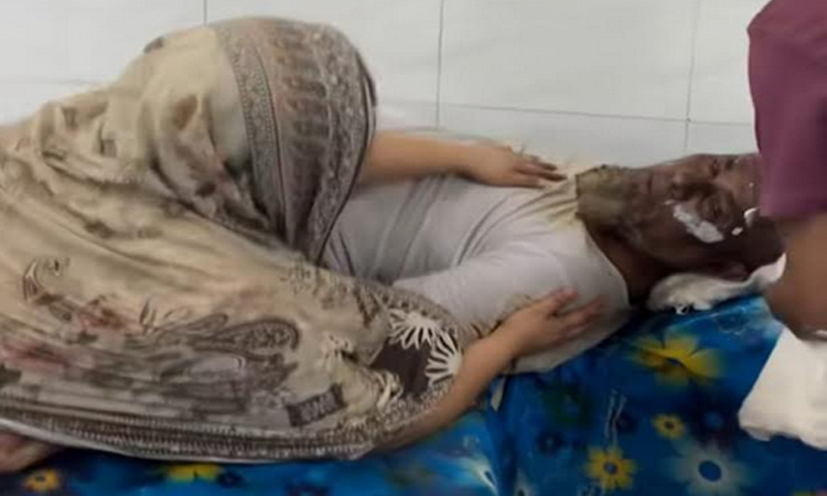 চাঁদপুরে চুলার গ্যাস বিস্ফোরণে এক পরিবারের ৬ জন দগ্ধ