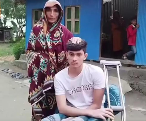 গণঅভ্যুত্থানে হামলার শিকার হয়ে পঙ্গুত্বের আশঙ্কায় তরুণ শাকিল