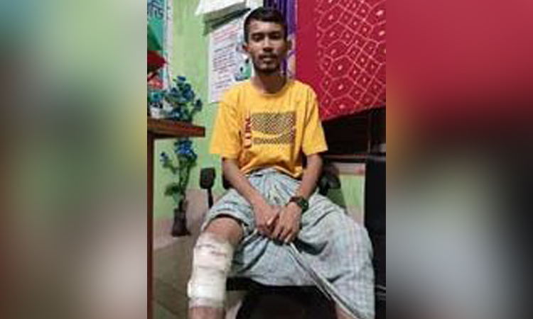 উন্নত চিকিৎসা না পেয়ে পঙ্গুত্বের শঙ্কায় দিন কাটছে বেল্লালের