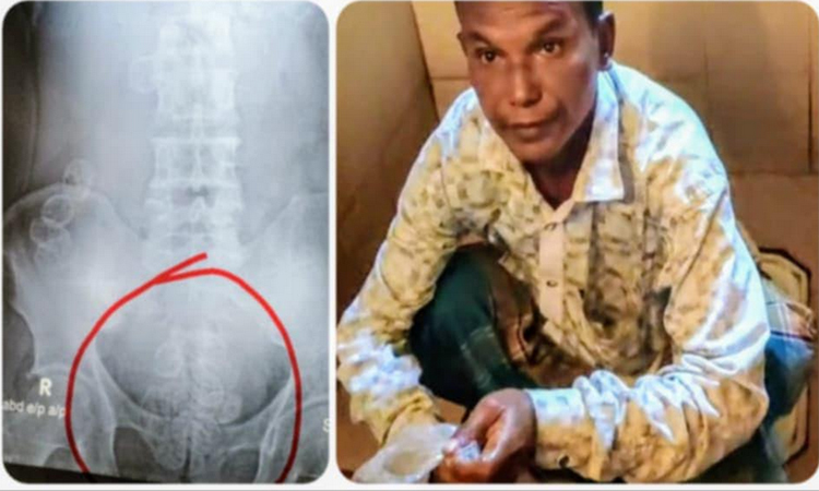 বগুড়ায় ব্যবসায়ীর পেট থেকে ১৩ প্যাকেট ইয়াবা উদ্ধার, গ্রেফতার ৩