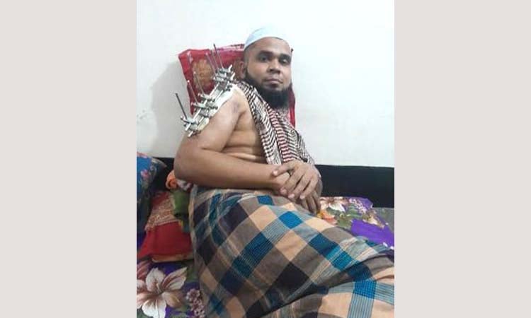 স্বাভাবিক জীবনে ফিরতে চান জুলাই যোদ্ধা বেল্লাল