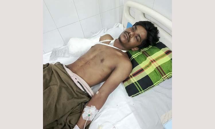 মৃত্যুকে খুব কাছ থেকে দেখে এসেছি : জুলাই বিপ্লবে হাত হারানো মঞ্জয় মল্লিক