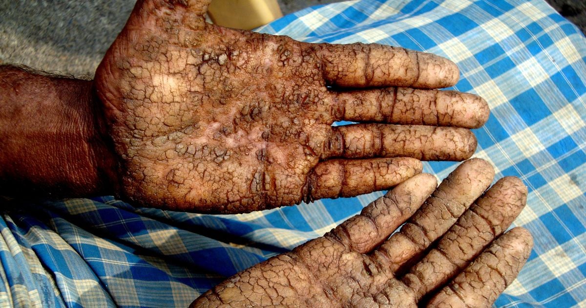 চাল ও সবজিতেও ক্ষতিকর আর্সেনিক : ঝুঁকিতে খাদ্য নিরাপত্তা