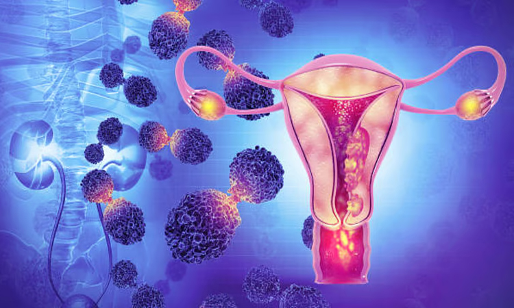 সচেতনতা দিয়েই জরায়ুমুখের ক্যান্সার রোধ সম্ভব 