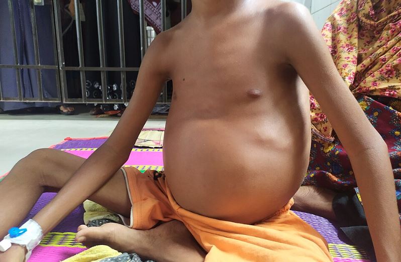 দেশে ২ কোটি মানুষ বহন করছে থ্যালাসেমিয়ার জিন  