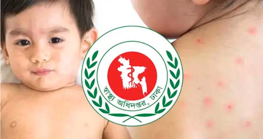 হাম সন্দেহে আরও ৪ জনের মৃত্যু