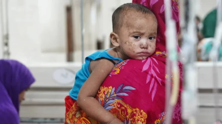 হাম আক্রান্ত সন্দেহে আরো ৩ জনের মৃত্যু